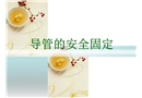 導管安全固定